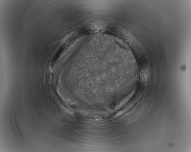 X0000098160570200805011433