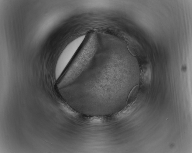 X0000098160574200805011433