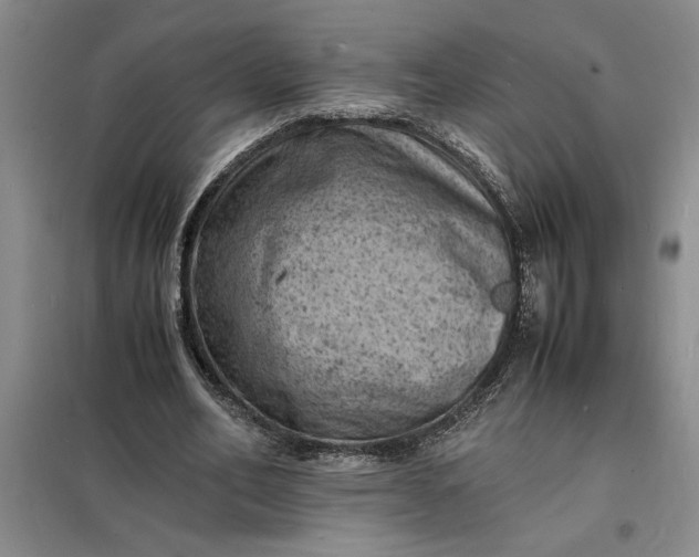 X0000098160582200805011433