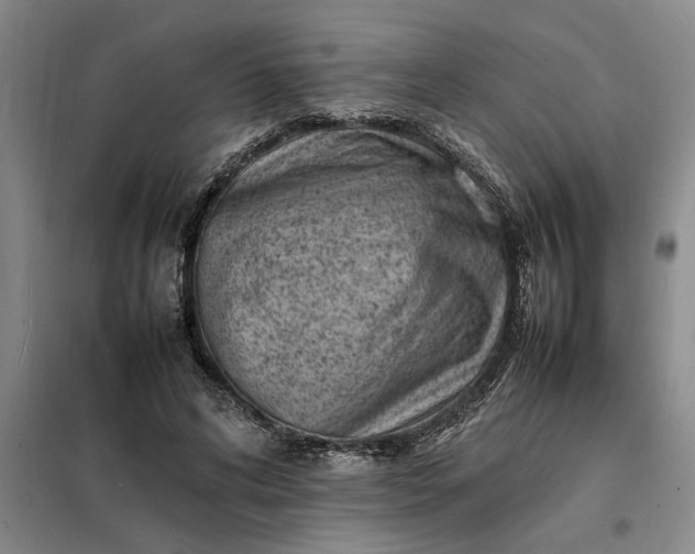 X0000098160592200805011433