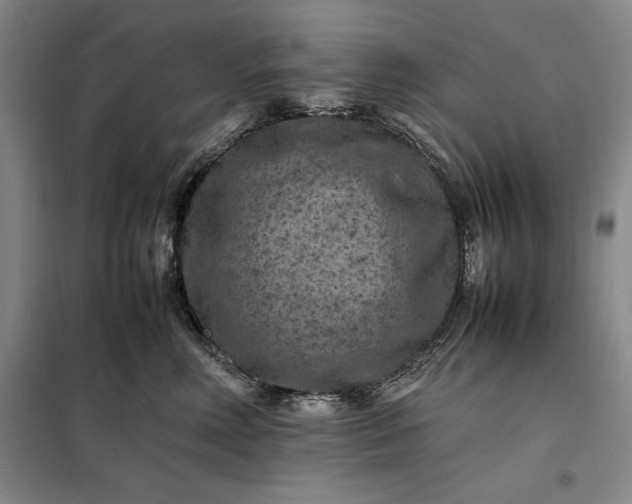 X0000098160618200805011432