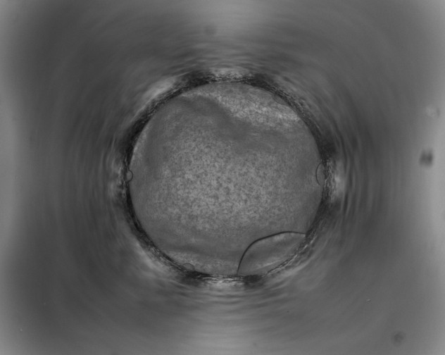 X0000098160619200805011432