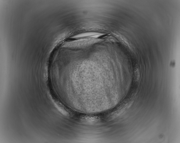 X0000098160638200805011431