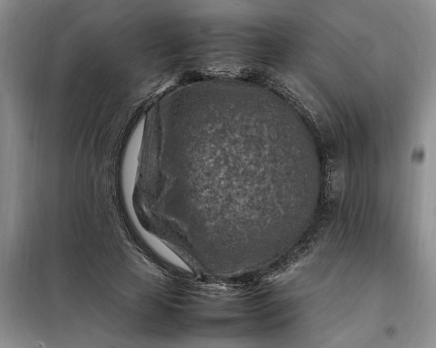 X0000098160641200805011431