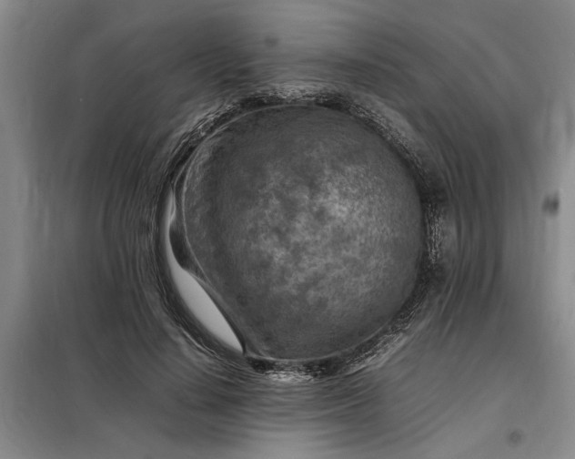 X0000098160644200805011432