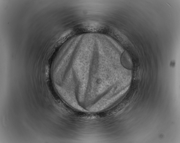 X0000098160646200805011432