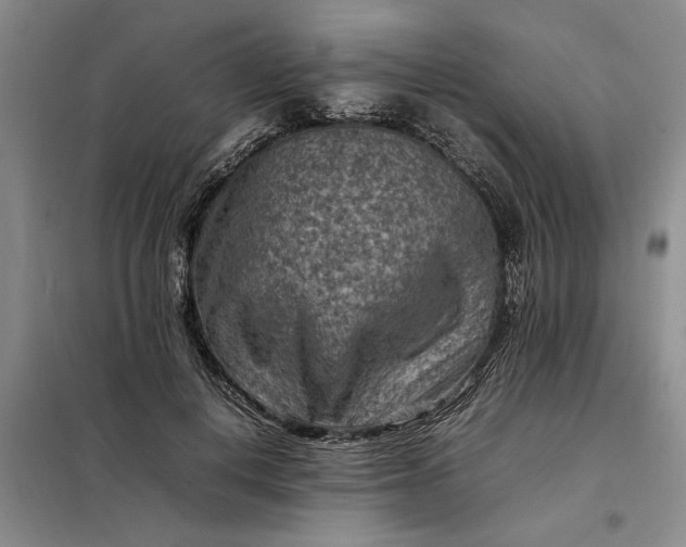 X0000098160648200805011432