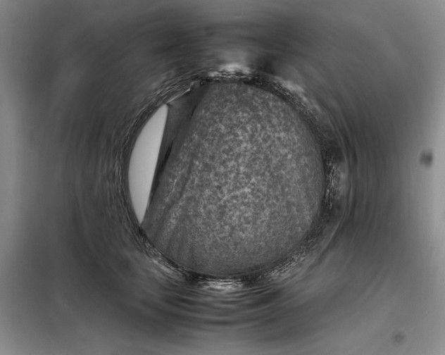 X0000098160659200805011432