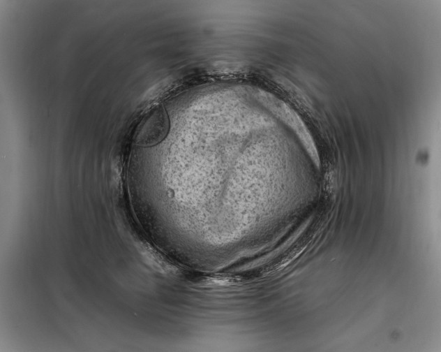 X0000098160662200805011432