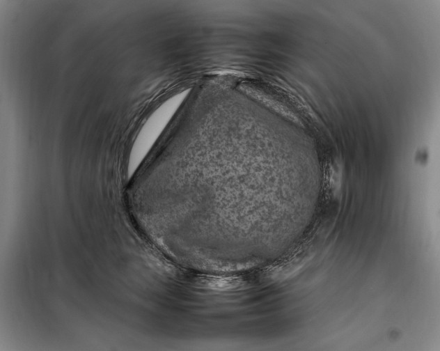 X0000098160663200805011432