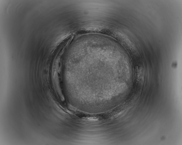 X0000098160692200805011431