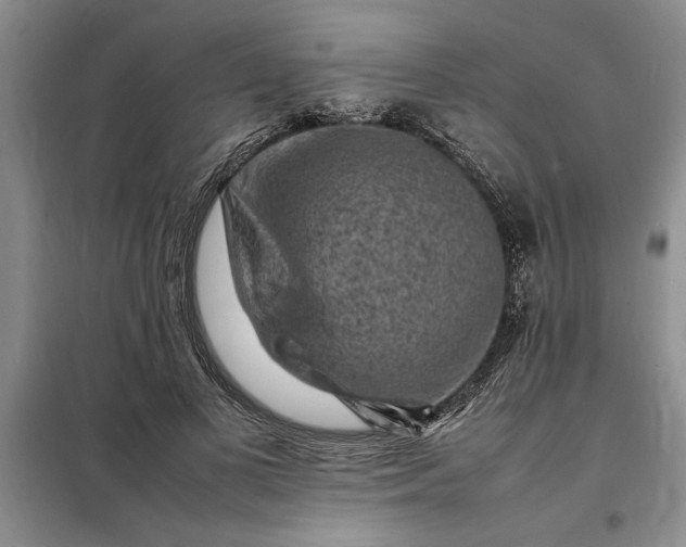 X0000098160693200805011431
