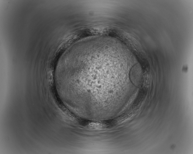 X0000098160699200805011431