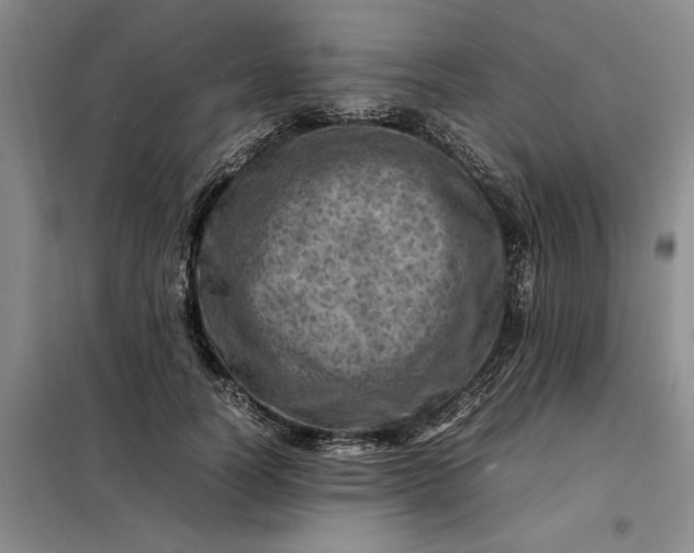 X0000098160746200805011430