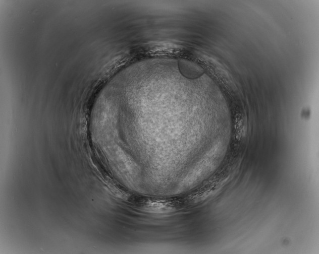 X0000098160753200805011430