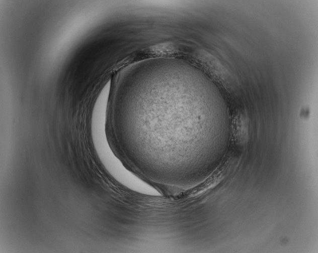 X0000098160762200805011430