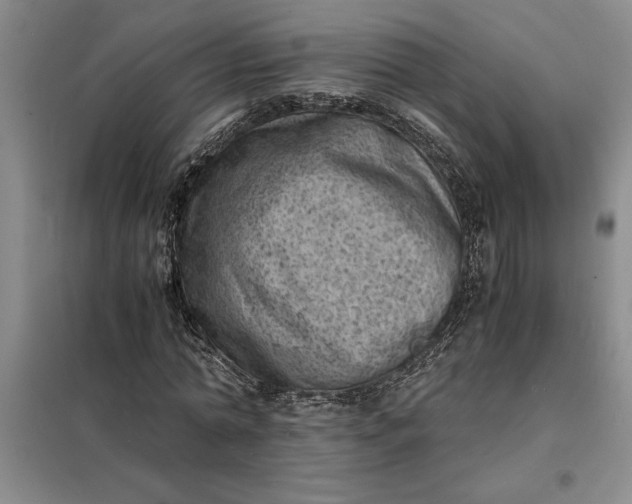 X0000098160774200805011430