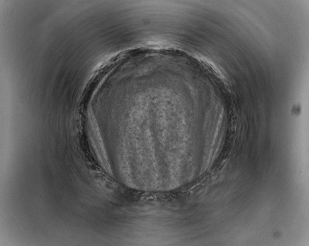 X0000098160776200805011430