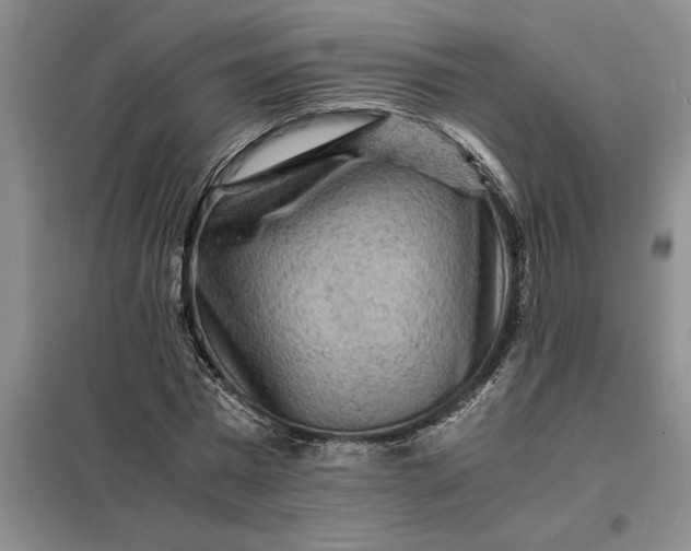 X0000098160777200805011430