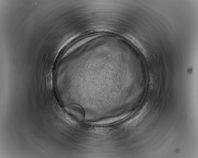 X0000098160782200805011430