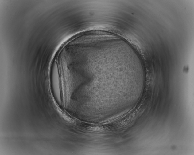X0000098160792200805011429