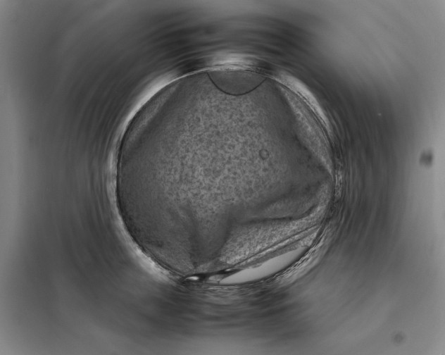 X0000098160859200805011429