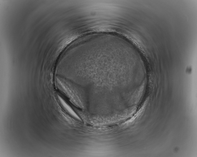 X0000098160881200805011428