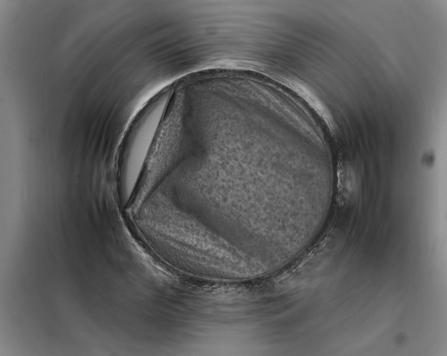 X0000098160972200805011427