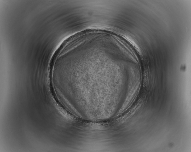 X0000098160976200805011427
