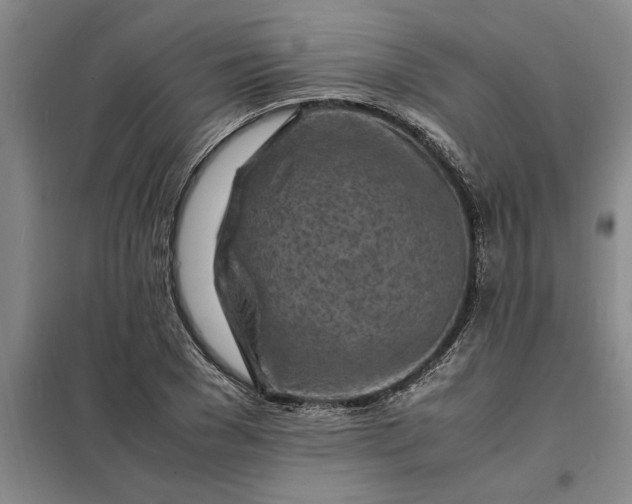 X0000098160977200805011427