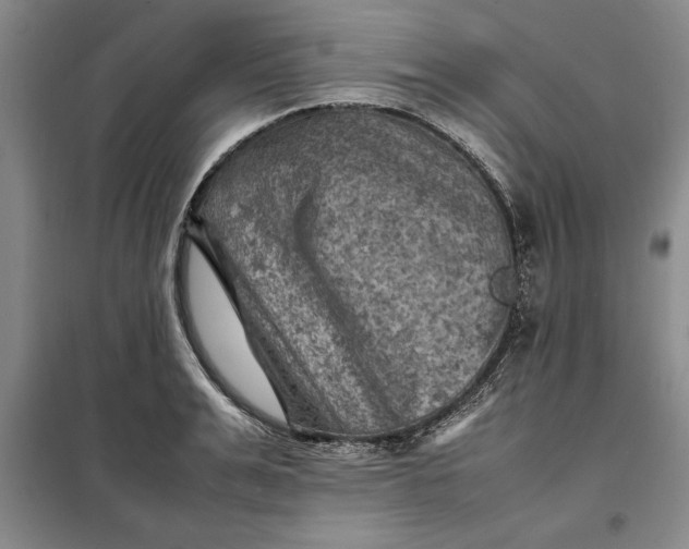 X0000098160991200805011426