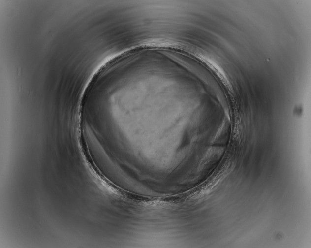 X0000098160992200805011426