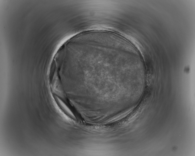 X0000098160995200805011426