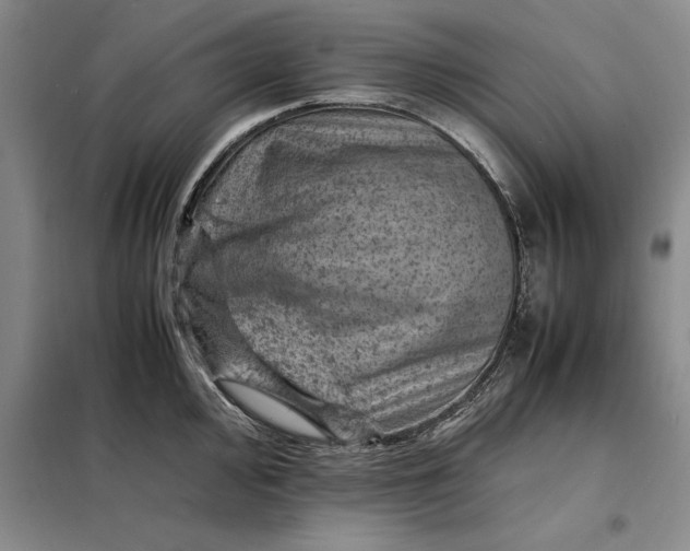 X0000098161000200805011426