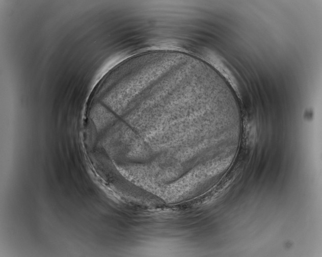 X0000098161002200805011426