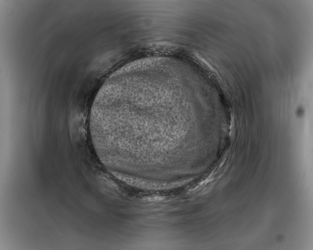 X0000098161010200805011425