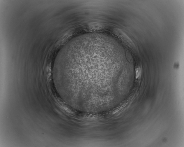 X0000098161011200805011425