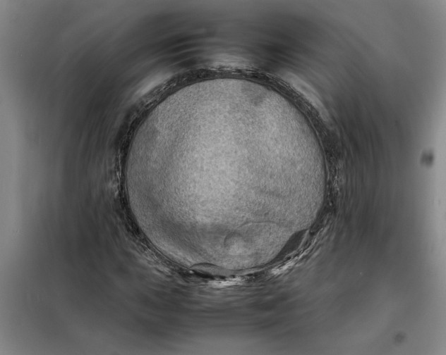 X0000098161015200805011426