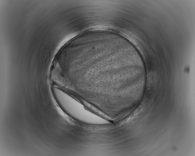 X0000098161042200805011426