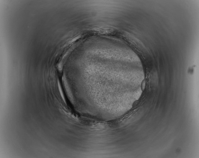 X0000098161058200805011425
