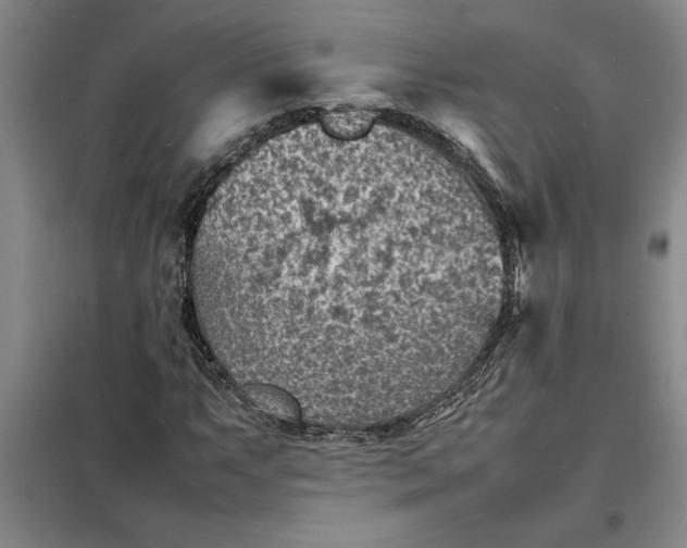 X0000098161063200805011425