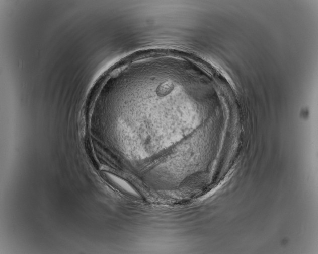 X0000098161069200805011425