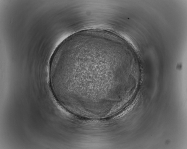 X0000098161079200805011425