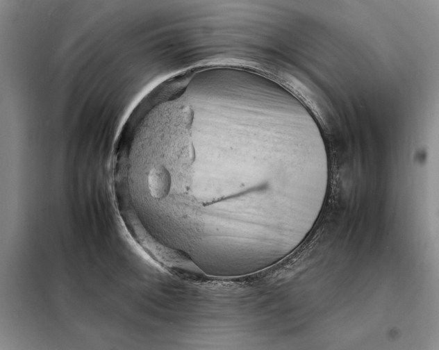 X0000098161092200805011425