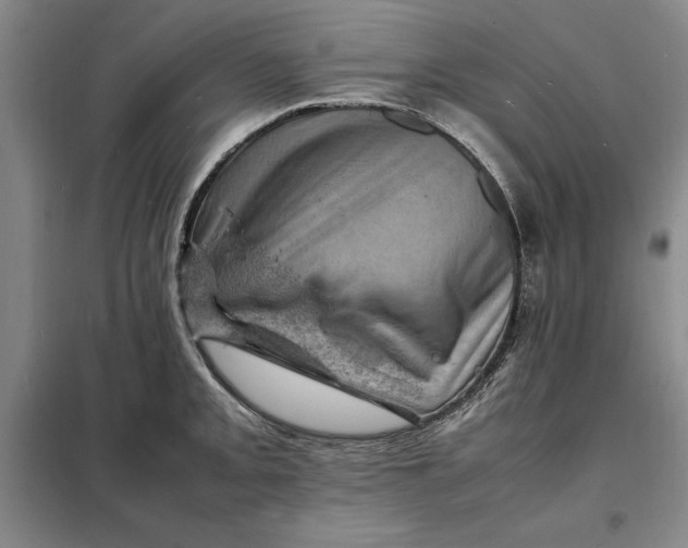 X0000098161093200805011425