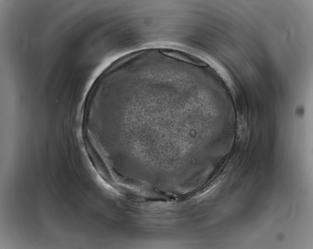 X0000098161102200805011425