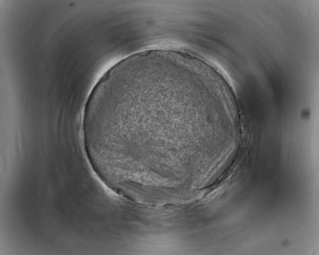 X0000098161103200805011425