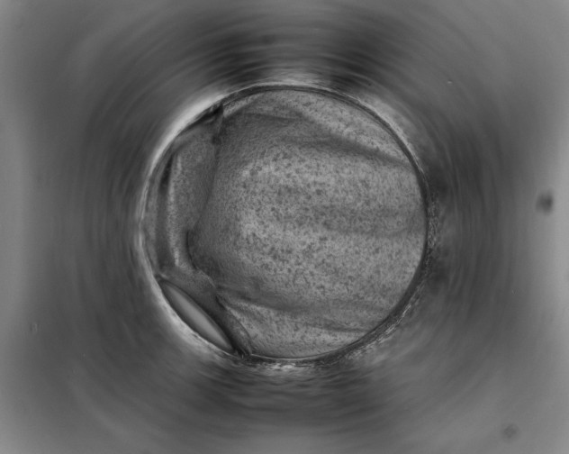 X0000098161139200805011425