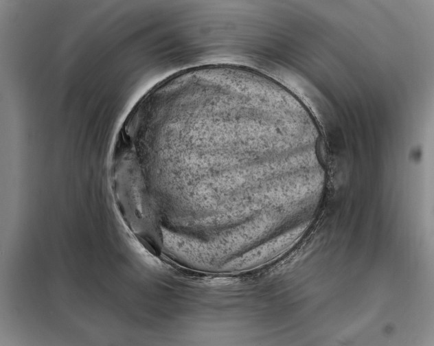 X0000098161140200805011425