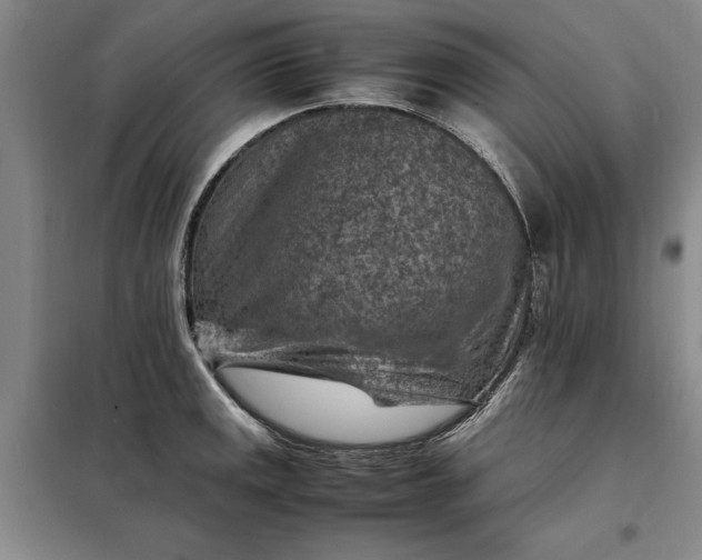 X0000098161141200805011425